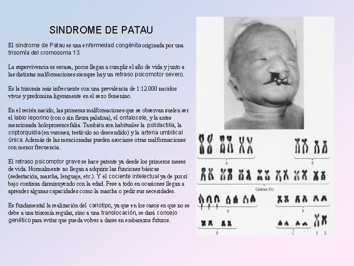 SINDROME DE PATAU El síndrome de Patau es una enfermedad congénita originada por una