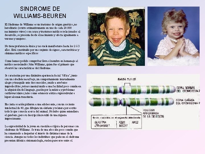 SINDROME DE WILLIAMS-BEUREN El Síndrome de Williams es un trastorno de origen genético, no