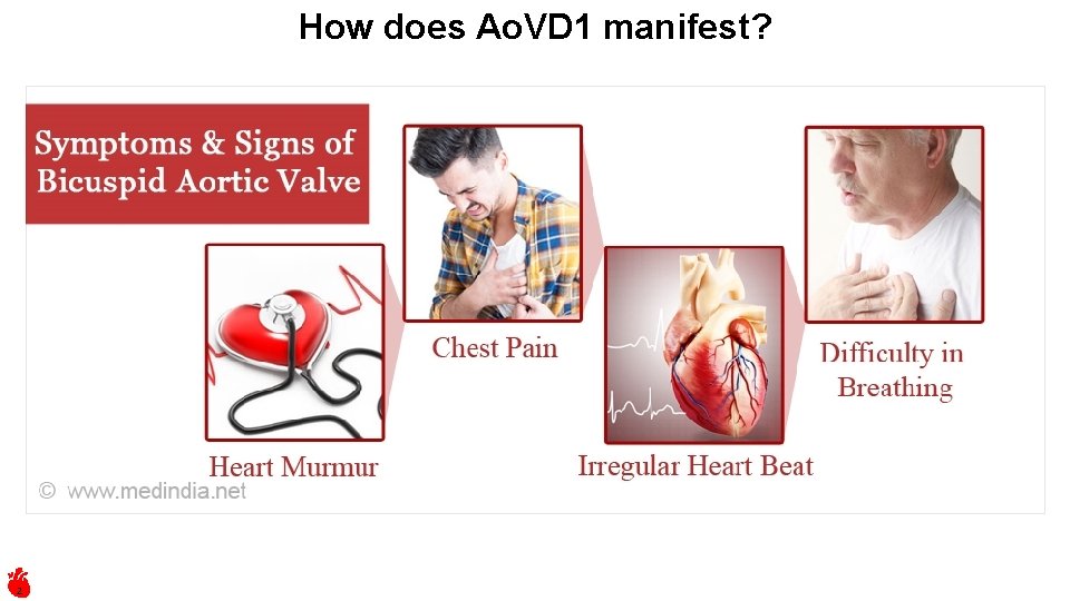 How does Ao. VD 1 manifest? 2 