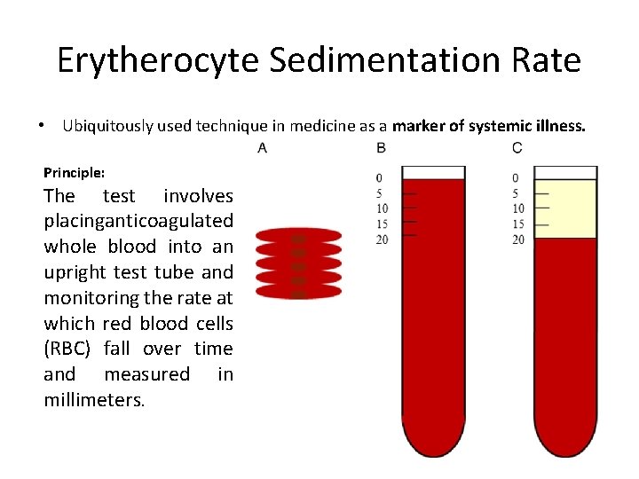 Erytherocyte Sedimentation Rate • Ubiquitously used technique in medicine as a marker of systemic