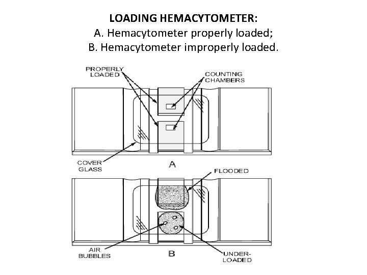 LOADING HEMACYTOMETER: A. Hemacytometer properly loaded; B. Hemacytometer improperly loaded. 