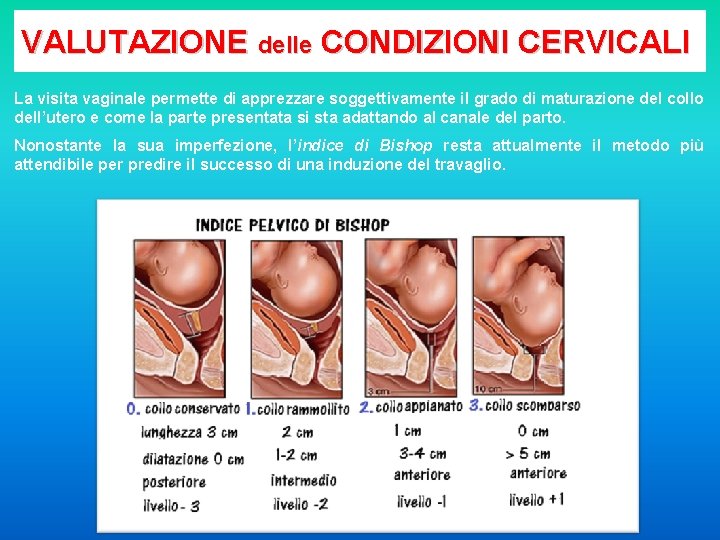 VALUTAZIONE delle CONDIZIONI CERVICALI La visita vaginale permette di apprezzare soggettivamente il grado di