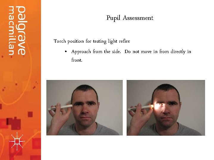 Pupil Assessment Torch position for testing light reflex • Approach from the side. Do