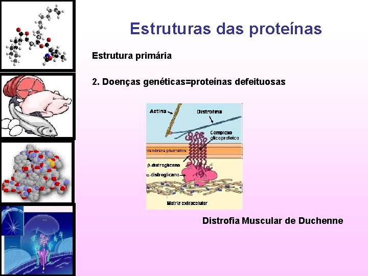 Estruturas das proteínas Estrutura primária 2. Doenças genéticas=proteínas defeituosas Distrofia Muscular de Duchenne 