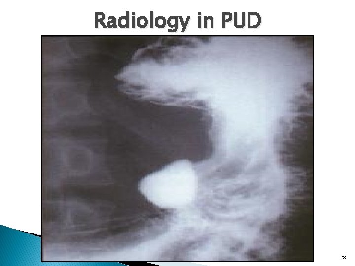 Radiology in PUD 28 