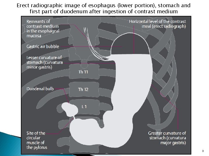 Erect radiographic image of esophagus (lower portion), stomach and first part of duodenum after