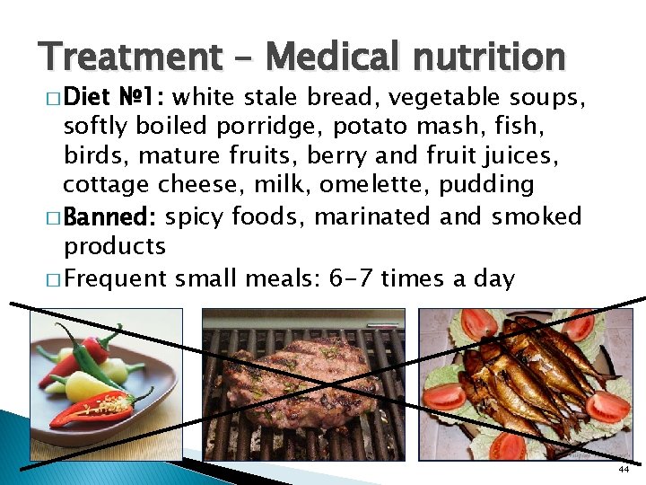 Treatment – Medical nutrition � Diet № 1: white stale bread, vegetable soups, softly