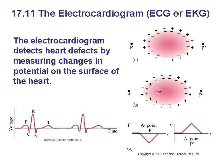 17. 11 The Electrocardiogram (ECG or EKG) The electrocardiogram detects heart defects by measuring