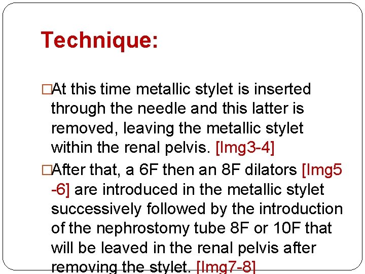 Technique: �At this time metallic stylet is inserted through the needle and this latter