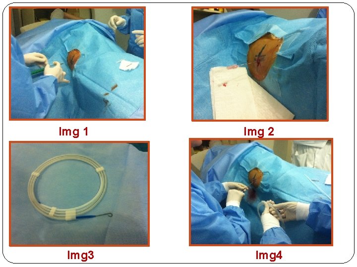 Img 1 Img 3 Img 2 Img 4 