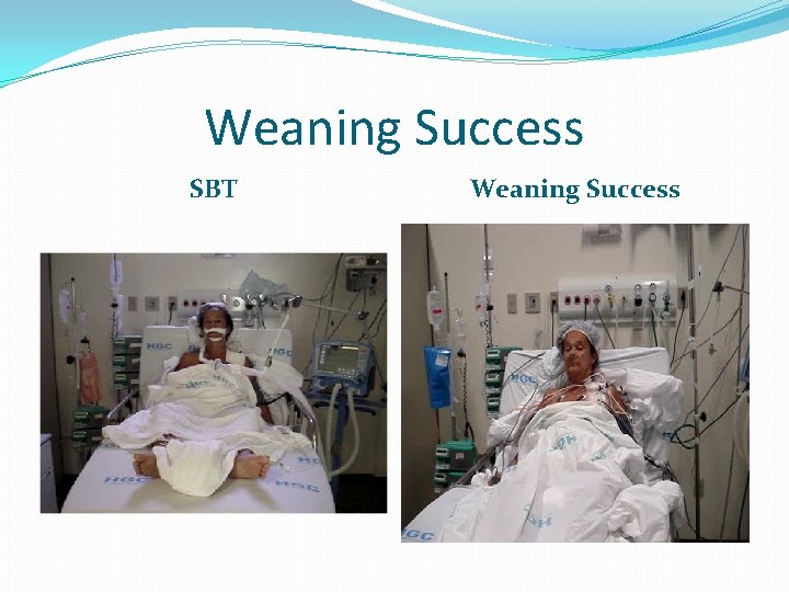 Weaning Success SBT Weaning Success 