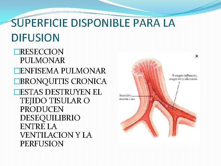 SUPERFICIE DISPONIBLE PARA LA DIFUSION �RESECCION PULMONAR �ENFISEMA PULMONAR �BRONQUITIS CRONICA �ESTAS DESTRUYEN EL SUPERFICIE DISPONIBLE PARA LA DIFUSION �RESECCION PULMONAR �ENFISEMA PULMONAR �BRONQUITIS CRONICA �ESTAS DESTRUYEN EL