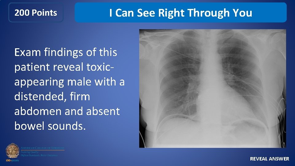 200 Points I Can See Right Through You Exam findings of this patient reveal