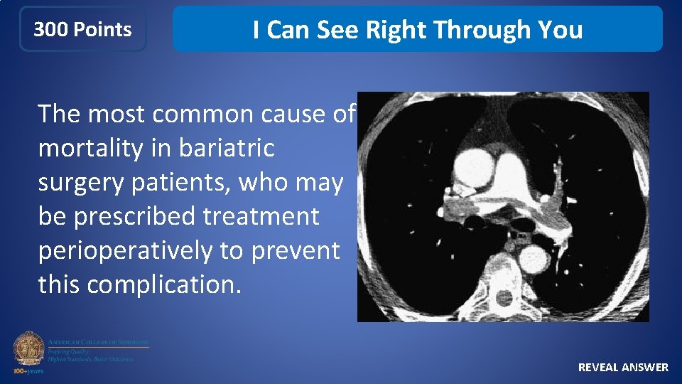 300 Points I Can See Right Through You The most common cause of mortality