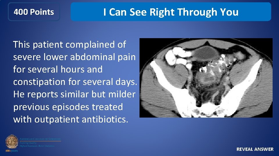 400 Points I Can See Right Through You This patient complained of severe lower