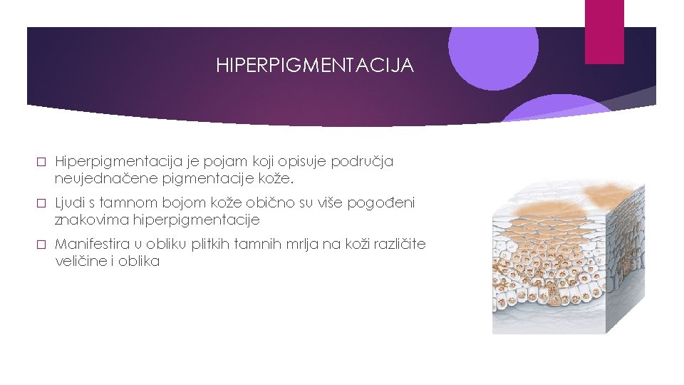 HIPERPIGMENTACIJA � Hiperpigmentacija je pojam koji opisuje područja neujednačene pigmentacije kože. � Ljudi s