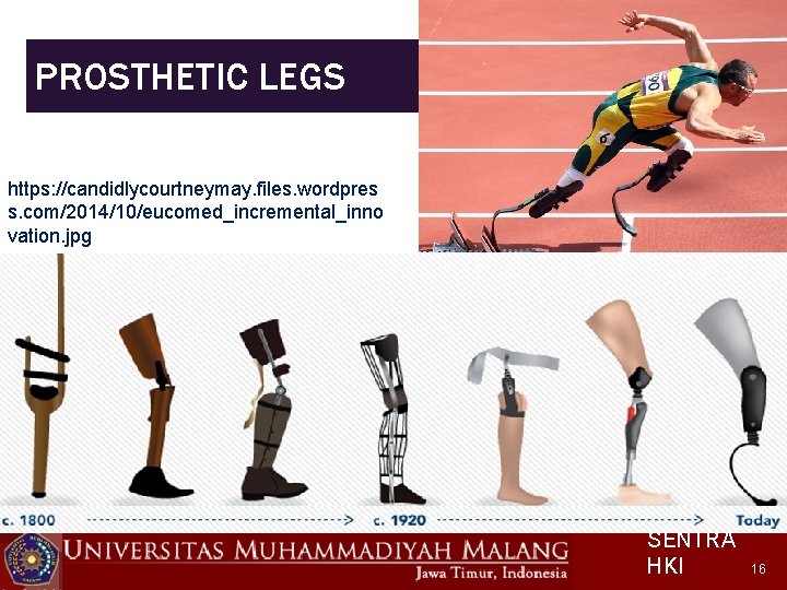 PROSTHETIC LEGS https: //candidlycourtneymay. files. wordpres s. com/2014/10/eucomed_incremental_inno vation. jpg SENTRA HKI 16 
