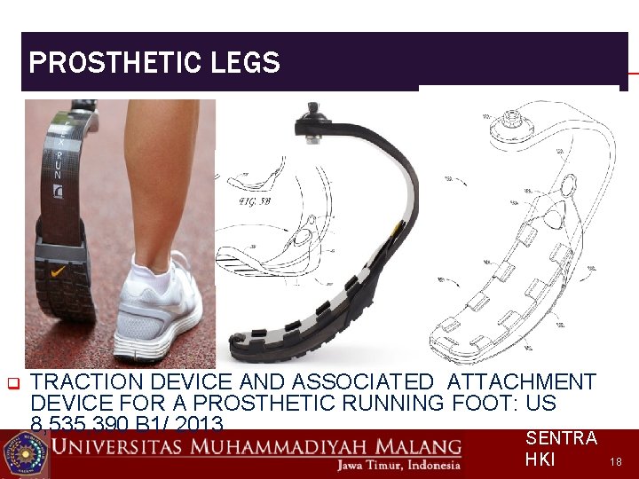 PROSTHETIC LEGS q TRACTION DEVICE AND ASSOCIATED ATTACHMENT DEVICE FOR A PROSTHETIC RUNNING FOOT: