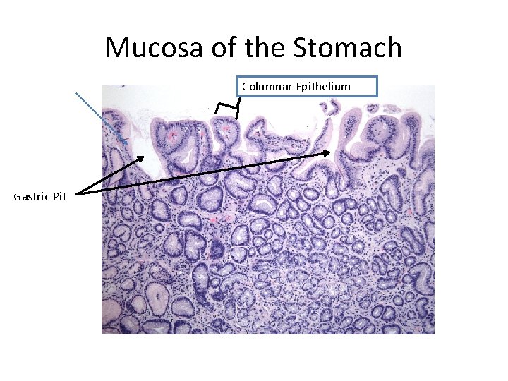 Mucosa of the Stomach Columnar Epithelium Gastric Pit 