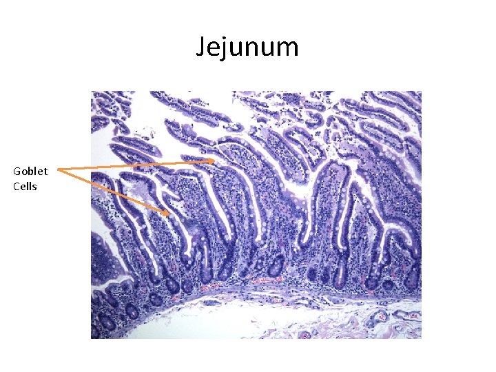 Jejunum Goblet Cells 