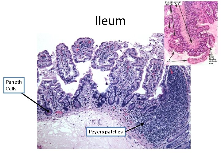 Ileum Paneth Cells Peyers patches 