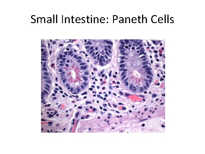 Small Intestine: Paneth Cells 
