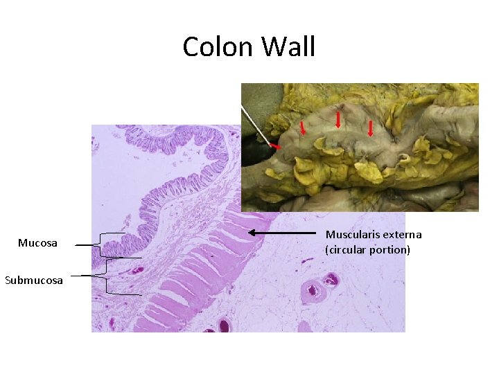 Colon Wall Mucosa Submucosa Muscularis externa (circular portion) 