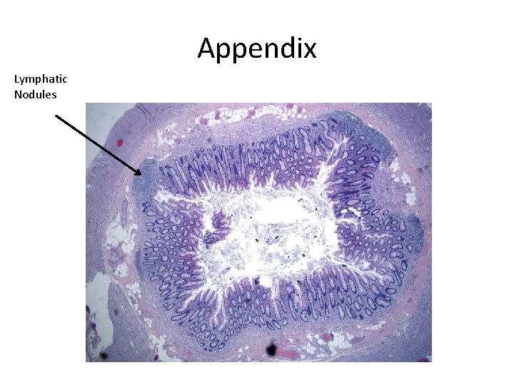 Appendix Lymphatic Nodules 