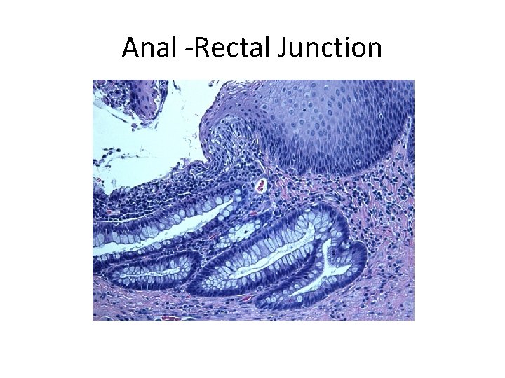 Anal -Rectal Junction 