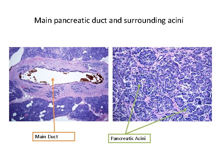 Main pancreatic duct and surrounding acini Main Duct Pancreatic Acini 