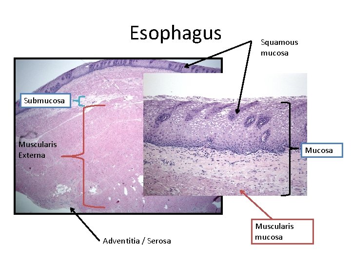 Esophagus Squamous mucosa Submucosa Muscularis Externa Mucosa Adventitia / Serosa Muscularis mucosa 