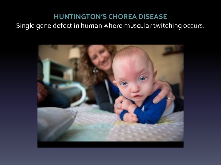 HUNTINGTON’S CHOREA DISEASE Single gene defect in human where muscular twitching occurs. 