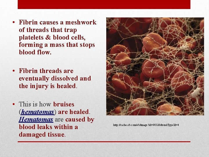  • Fibrin causes a meshwork of threads that trap platelets & blood cells,
