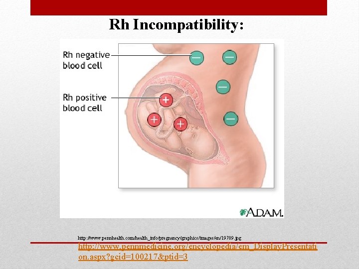 Rh Incompatibility: http: //www. pennhealth. com/health_info/pregnancy/graphics/images/en/19789. jpg http: //www. pennmedicine. org/encyclopedia/em_Display. Presentati on. aspx?