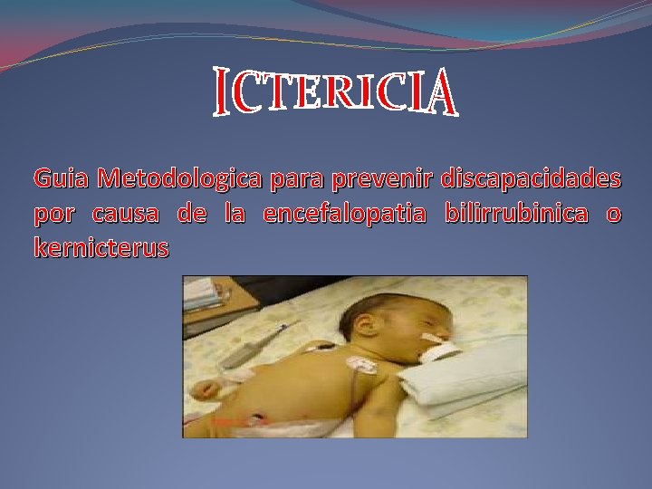 Guia Metodologica para prevenir discapacidades por causa de la encefalopatia bilirrubinica o kernicterus Guia Metodologica para prevenir discapacidades por causa de la encefalopatia bilirrubinica o kernicterus