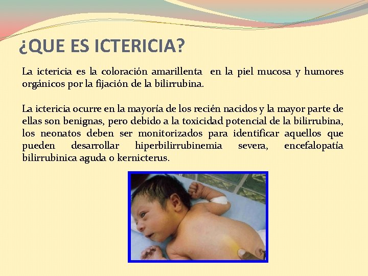 ¿QUE ES ICTERICIA? La ictericia es la coloración amarillenta en la piel mucosa y ¿QUE ES ICTERICIA? La ictericia es la coloración amarillenta en la piel mucosa y