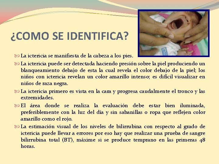 ¿COMO SE IDENTIFICA? La ictericia se manifiesta de la cabeza a los pies. La