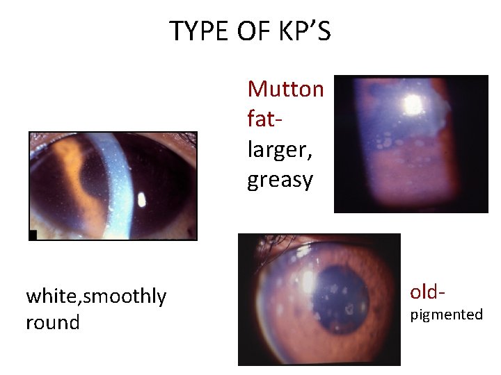 TYPE OF KP’S Mutton fatlarger, greasy white, smoothly round old- pigmented 