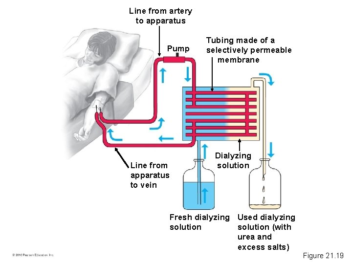 Line from artery to apparatus Pump Line from apparatus to vein Tubing made of