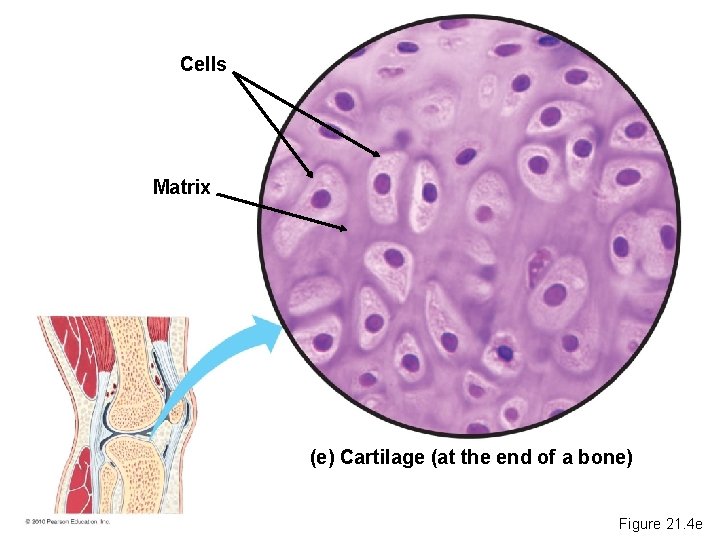 Cells Matrix (e) Cartilage (at the end of a bone) Figure 21. 4 e