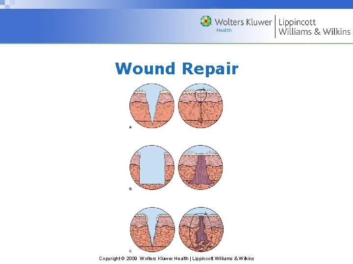 Wound Repair Copyright © 2009 Wolters Kluwer Health | Lippincott Williams & Wilkins 