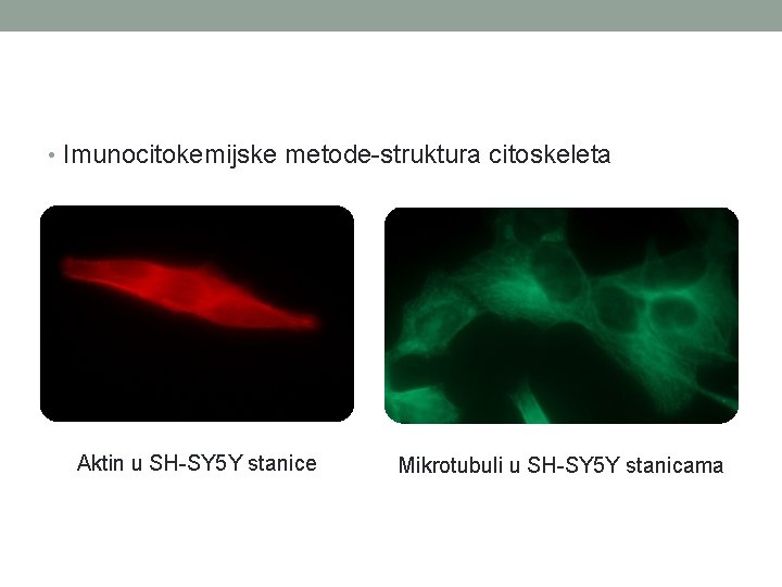  • Imunocitokemijske metode-struktura citoskeleta Aktin u SH-SY 5 Y stanice Mikrotubuli u SH-SY