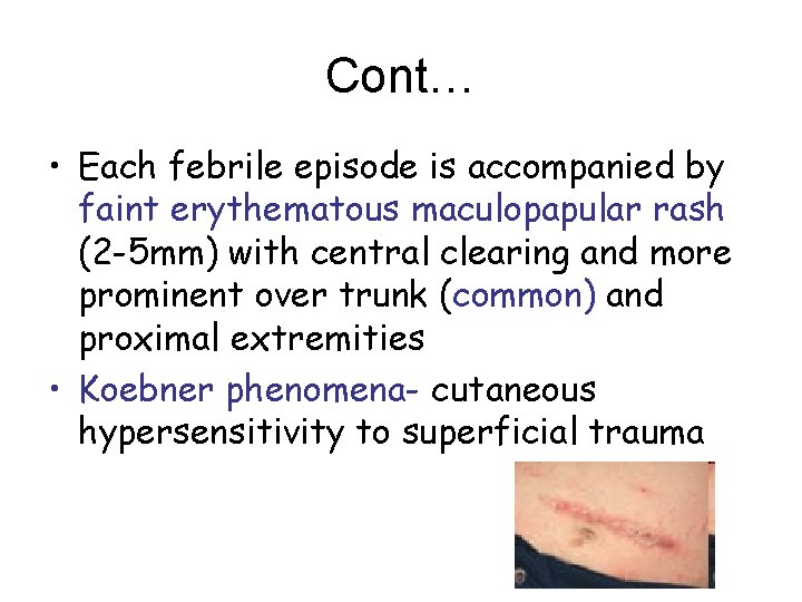 Cont… • Each febrile episode is accompanied by faint erythematous maculopapular rash (2 -5