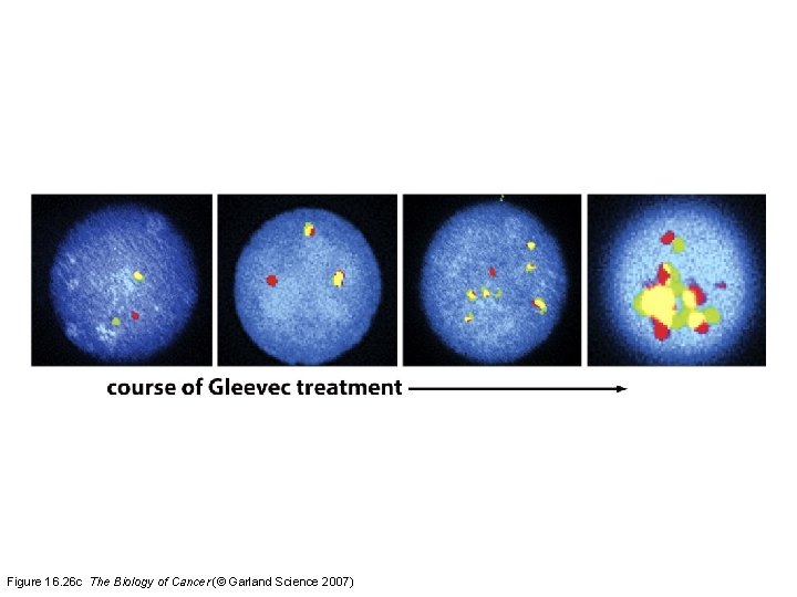 Figure 16. 26 c The Biology of Cancer (© Garland Science 2007) 