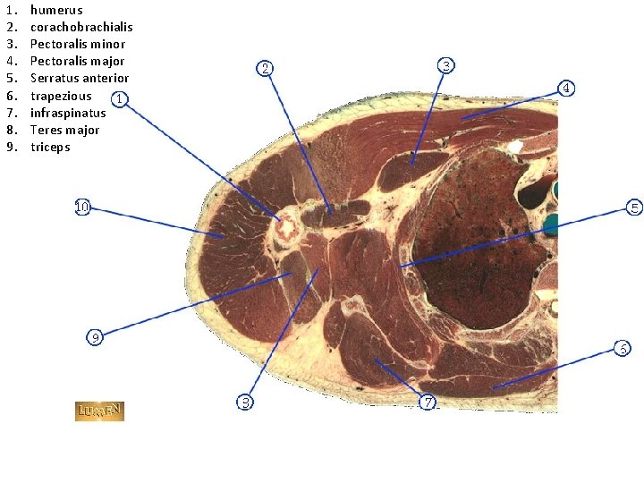 1. 2. 3. 4. 5. 6. 7. 8. 9. humerus corachobrachialis Pectoralis minor Pectoralis