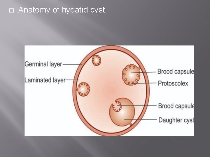 � Anatomy of hydatid cyst. 