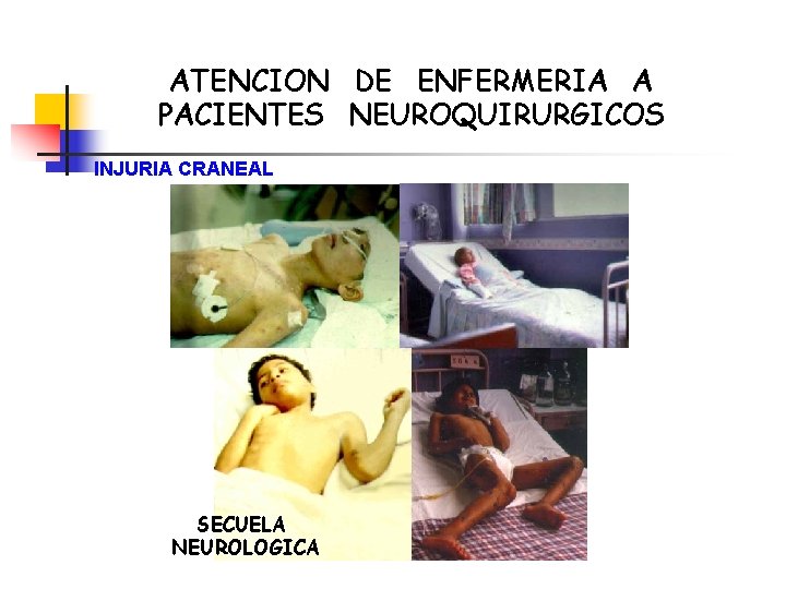 ATENCION DE ENFERMERIA A PACIENTES NEUROQUIRURGICOS INJURIA CRANEAL SECUELA NEUROLOGICA 