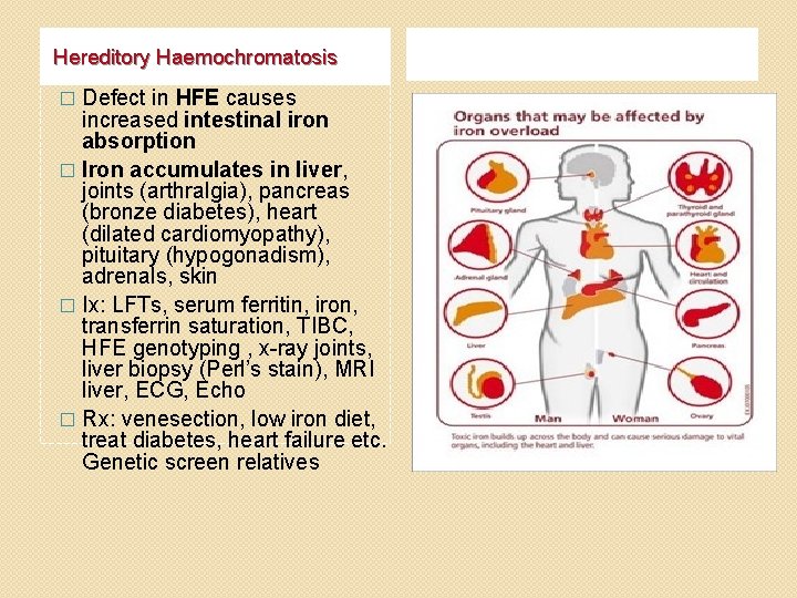 Hereditory Haemochromatosis Defect in HFE causes increased intestinal iron absorption � Iron accumulates in