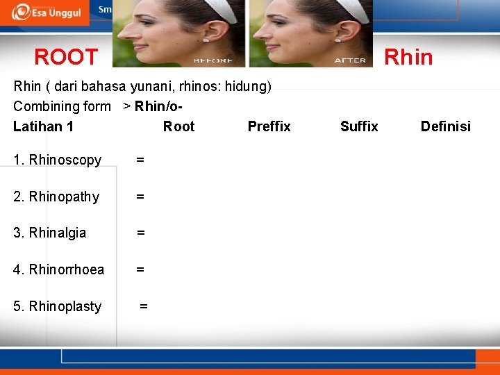 ROOT Rhin ( dari bahasa yunani, rhinos: hidung) Combining form > Rhin/o. Latihan 1