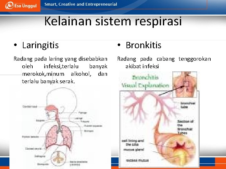 Kelainan sistem respirasi • Laringitis • Bronkitis Radang pada laring yang disebabkan oleh infeksi,